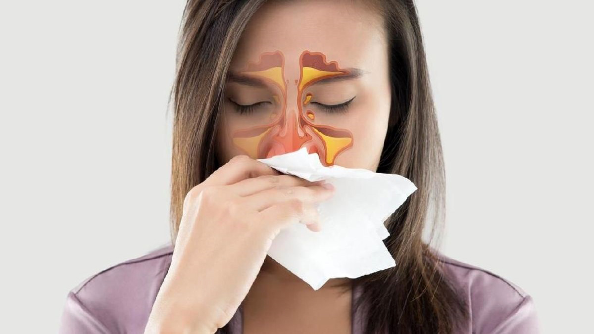 Cara Mengatasi Sinusitis Secara Alami